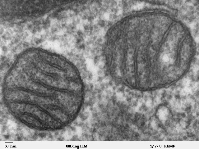 哺乳類肺組織のミトコンドリア透過電子顕微鏡像